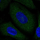 Immunofluorescent staining of human cell line U-2 OS shows localization to cytosol.