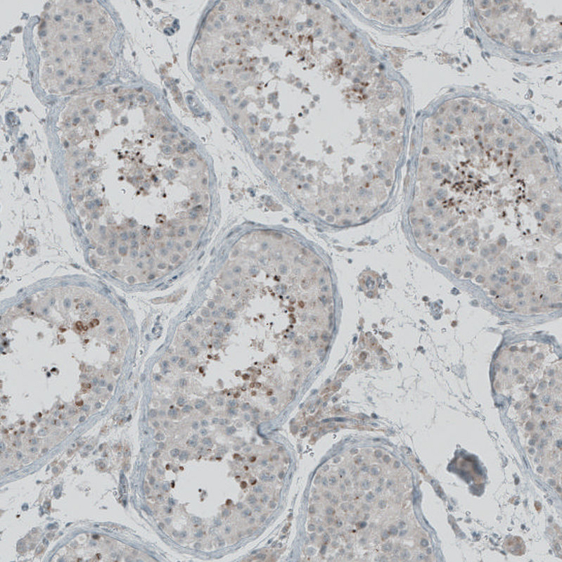 Anti-FBF1 Antibody