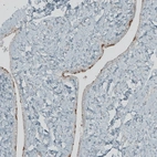Immunohistochemical staining of human fallopian tube shows weak membranous positivity in glandular cells.