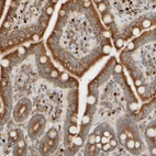 Immunohistochemical staining of human duodenum shows strong cytoplasmic positivity in glandular cells.