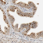 Immunohistochemical staining of human Fallopian tube shows strong cytoplasmic positivity in a subset of glandular cells.