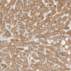 Immunohistochemical staining of human liver shows moderate cytoplasmic positivity in hepatocytes.
