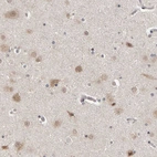 Immunohistochemical staining of human cerebral cortex shows weak to moderate cytoplasmic positivity in neurons.