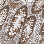 Immunohistochemical staining of human colon shows moderate to strong positivity in mitochondria in glandular cells.