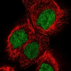 Immunofluorescent staining of human cell line A-431 shows localization to nucleoplasm.