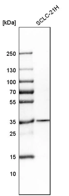 Western blot analysis in human cell line SCLC-21H.