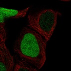 Immunofluorescent staining of human cell line A-431 shows localization to nucleoplasm.