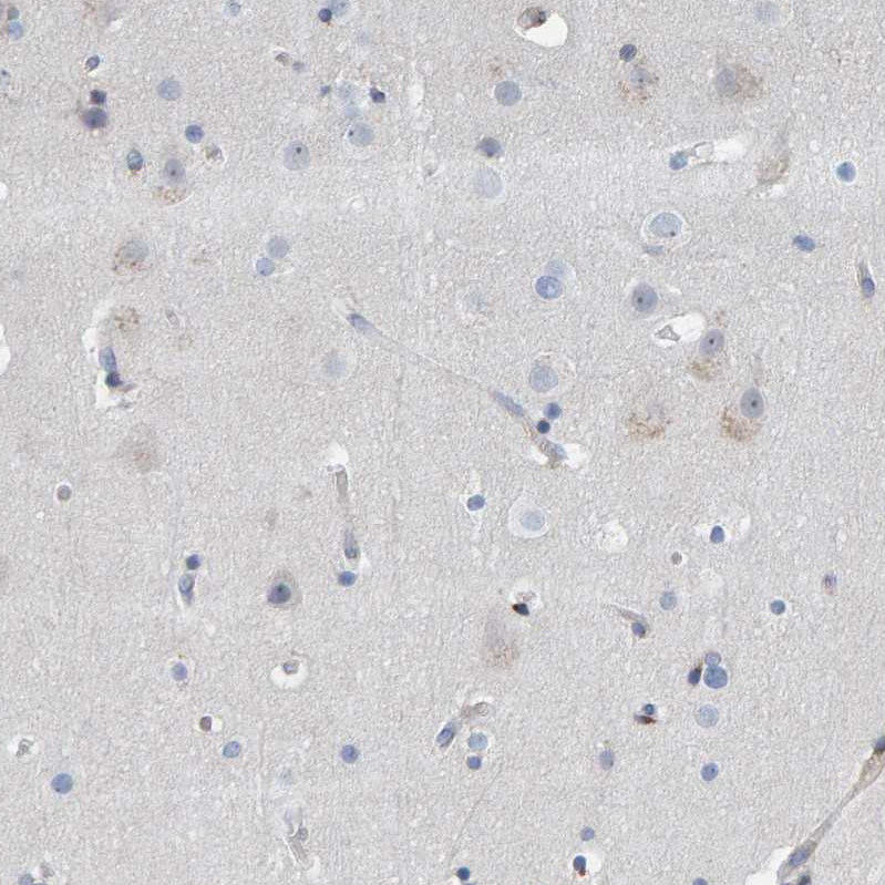 Anti-MMP16 Antibody