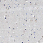 Anti-MMP16 Antibody