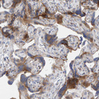 Immunohistochemical staining of human placenta shows moderate cytoplasmic positivity in trophoblastic cells.