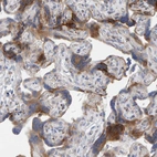 Immunohistochemical staining of human placenta shows moderate cytoplasmic positivity in trophoblastic cells.