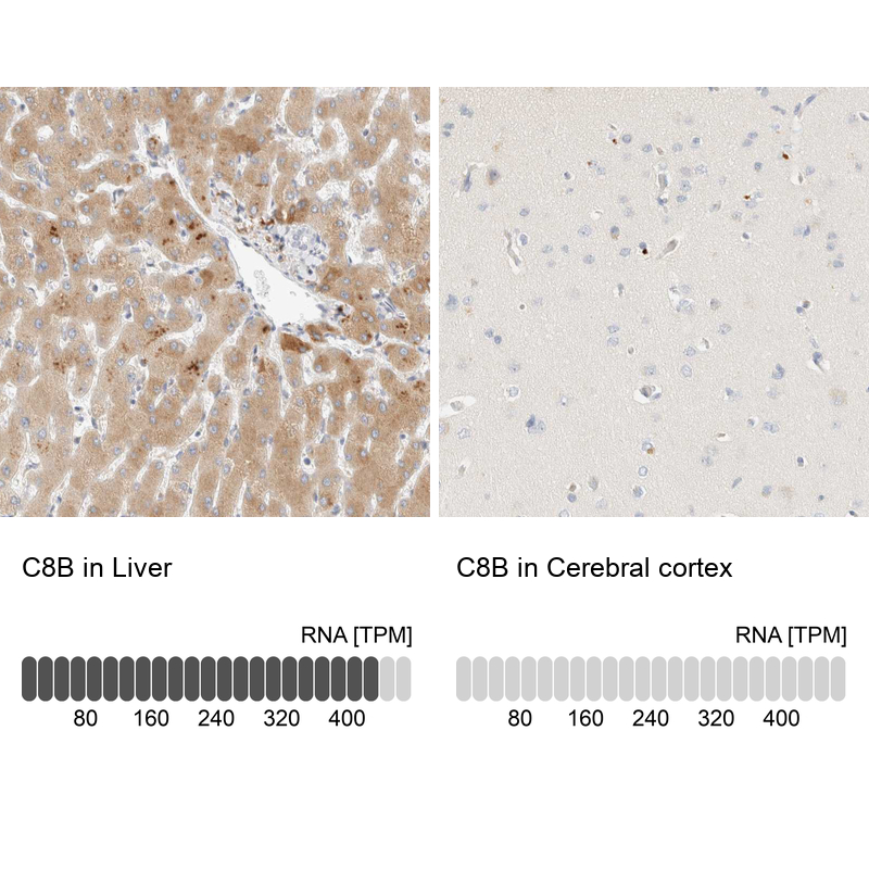 Anti-C8B Antibody
