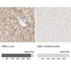 Anti-C8B Antibody