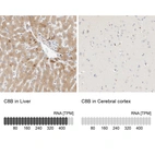 Anti-C8B Antibody