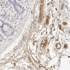 Immunohistochemical staining of human colon shows weak to moderate positivity in plasma in endothelial cells.