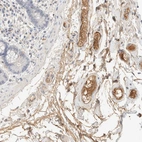 Immunohistochemical staining of human colon shows weak to moderate positivity in plasma in endothelial cells.