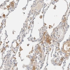 Immunohistochemical staining of human lung shows weak to moderate cytoplasmic positivity in macrophages.