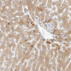 Immunohistochemical staining of human liver shows weak to moderate cytoplasmic positivity in hepatocytes.