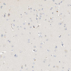 Immunohistochemical staining of human cerebral cortex shows no positivity in neurons.