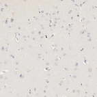 Immunohistochemical staining of human cerebral cortex shows no positivity in neurons.