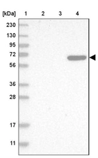 Lane 1: Marker [kDa] 230, 130, 95, 72, 56, 36, 28, 17, 11_br/_Lane 2: Human cell line RT-4_br/_Lane 3: Human cell line U-251MG sp_br/_Lane 4: Human plasma (IgG/HSA depleted)