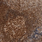 Anti-C8orf76 Antibody