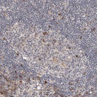 Anti-TBC1D31 Antibody