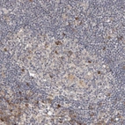 Anti-TBC1D31 Antibody