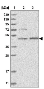 Lane 1: Marker [kDa] 230, 130, 95, 72, 56, 36, 28, 17, 11_br/_Lane 2: Human cell line RT-4_br/_Lane 3: Human cell line U-251MG sp