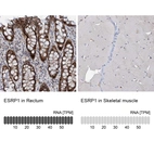 Anti-ESRP1 Antibody