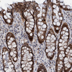Immunohistochemical staining of human rectum shows strong nuclear positivity in glandular cells.
