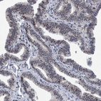 Anti-ESRP1 Antibody