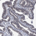 Immunohistochemical staining of human Fallopian tube shows moderate nuclear positivity in a subset of glandular cells.