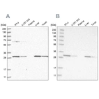 Western blot analysis using Anti-PROSC antibody HPA023733 (A) shows similar pattern to independent antibody HPA023646 (B).