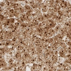 Anti-KIFAP3 Antibody