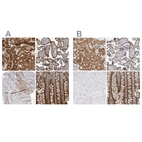 Immunohistochemical staining of human kidney, placenta, skeletal muscle and small intestine using Anti-NAPRT antibody HPA023739 (A) shows similar protein distribution across tissues to independent antibody HPA024017 (B).