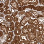Immunohistochemical staining of human kidney shows strong cytoplasmic positivity in cells in tubules.