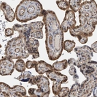 Immunohistochemical staining of human placenta shows strong cytoplasmic positivity in trophoblastic cells.