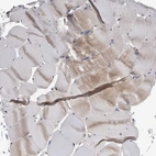 Immunohistochemical staining of human skeletal muscle shows no positivity in myocytes as expected.