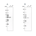 Western blot analysis using Anti-NAPRT antibody HPA023739 (A) shows similar pattern to independent antibody HPA024017 (B).