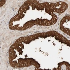 Anti-PPP1R16A Antibody
