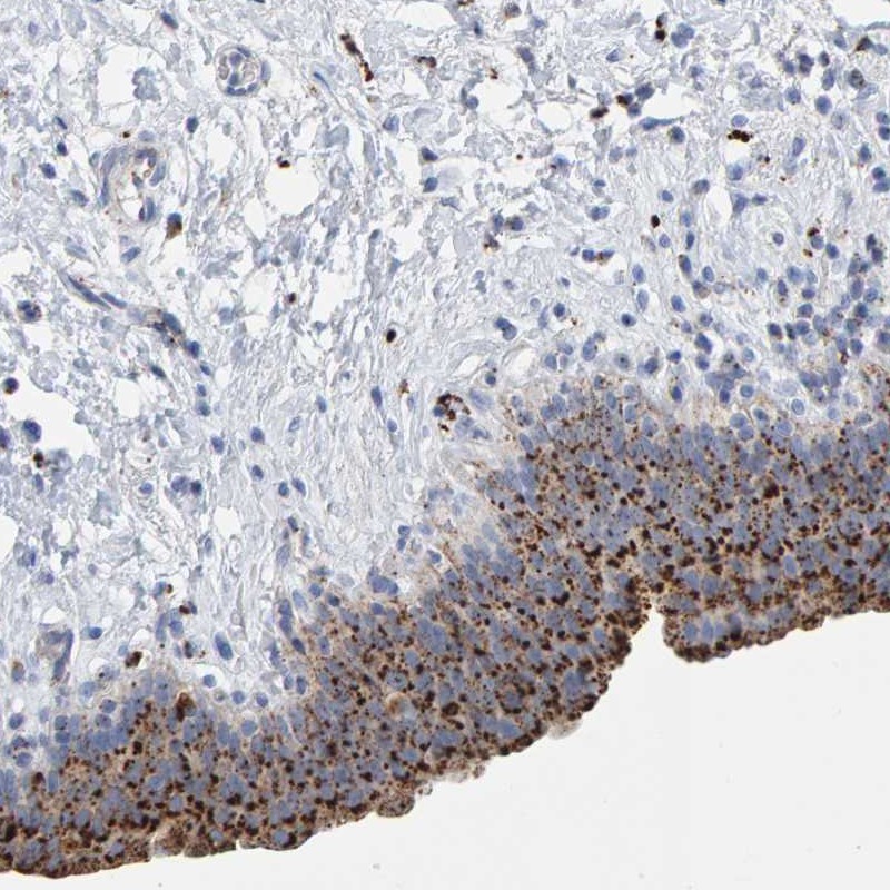 Anti-BIN3 Antibody