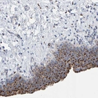 Anti-BIN3 Antibody