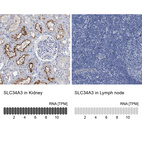 Anti-SLC34A3 Antibody