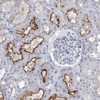Anti-SLC34A3 Antibody