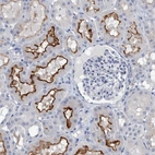 Immunohistochemical staining of human kidney shows high expression.