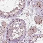 Anti-C1orf112 Antibody