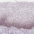 Immunohistochemical staining of human cervix, uterine shows strong nuclear positivity in squamous epithelial cells.