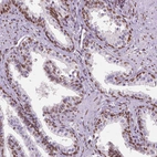 Immunohistochemical staining of human prostate shows strong nuclear positivity in glandular cells.