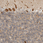 Immunohistochemical staining of human cerebellum shows strong cytoplasmic positivity in Purkinje cells.